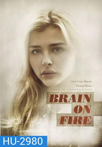 Brain on Fire เผชิญหน้า ท้าปาฏิหาริย์